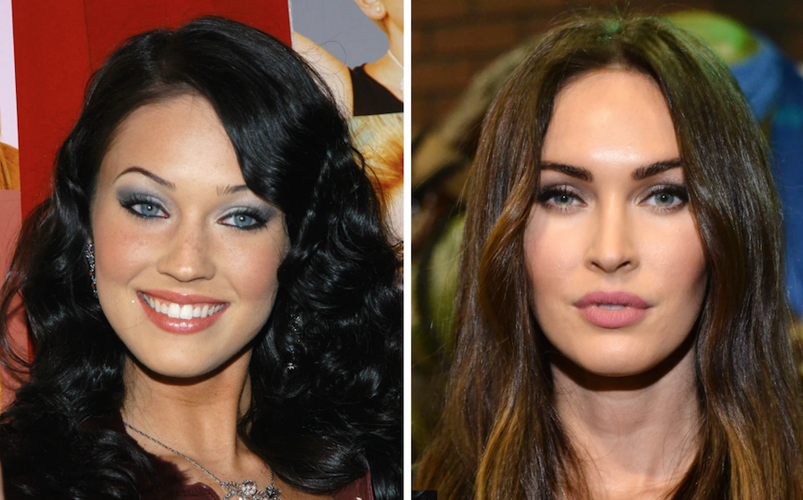 Celebrities Before And After Cosmetic Procedures