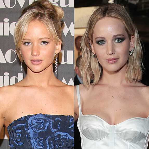 botox brow lift Jennier Lawrence