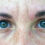 Do I Need a Blepharoplasty? Signs You Need to Get an Eye Lift